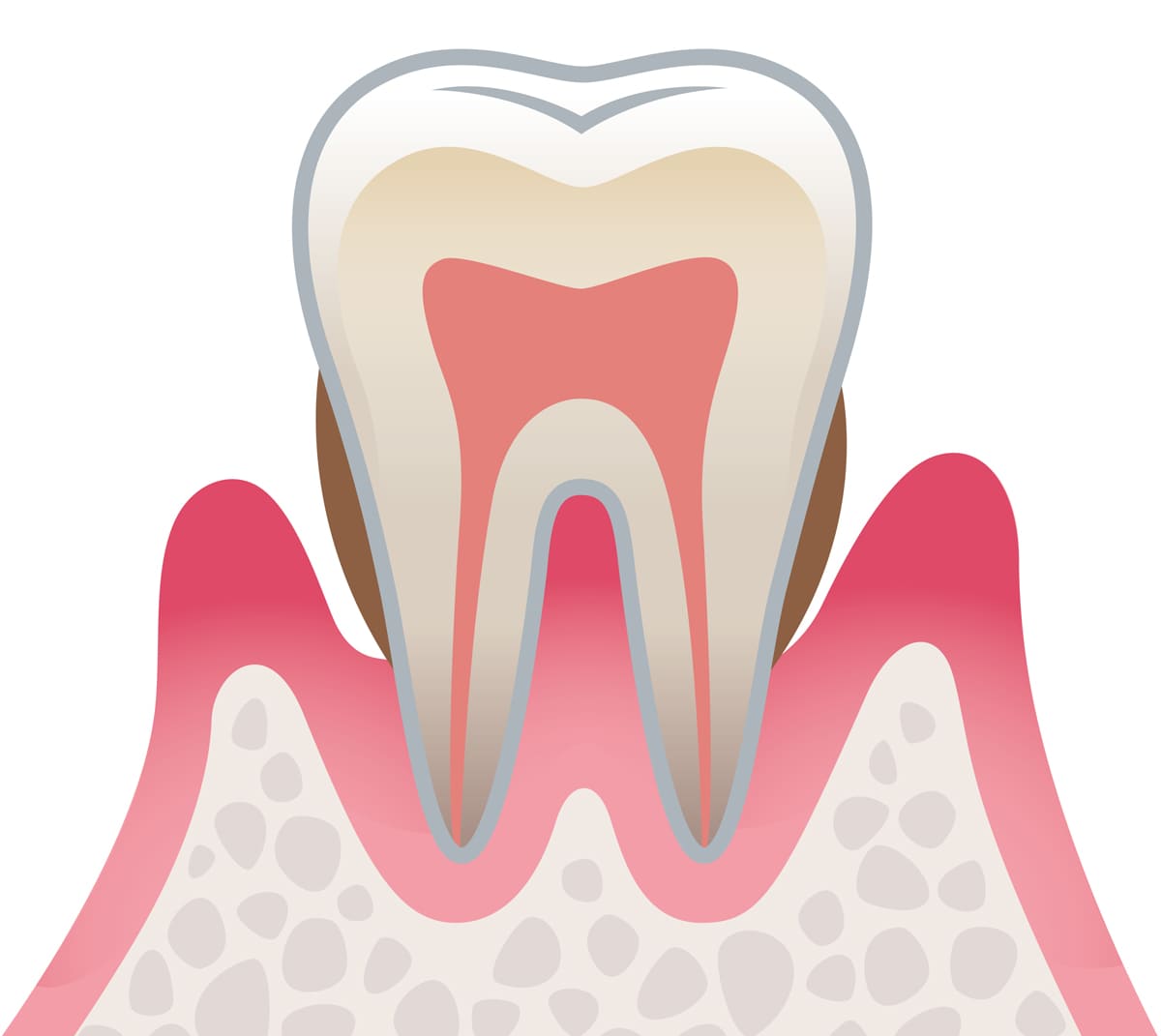 高知県　高知市　アポロニア歯科クリニック　歯周病予防の大切さについて